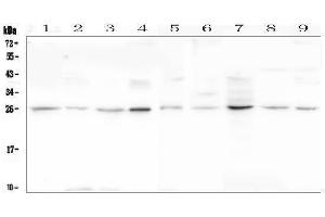 Western blot analysis of LOR using anti-LOR antibody (ABIN6719582).