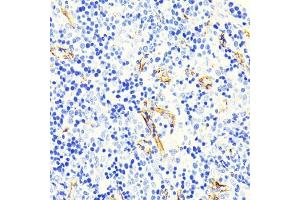 Immunohistochemistry of paraffin-embedded mouse spleen using Caveolin-1 Rabbit mAb (ABIN7266154) at dilution of 1:100 (40x lens). (Caveolin-1 抗体)