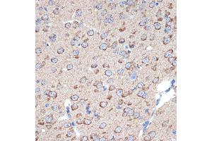 Immunohistochemistry of paraffin-embedded mouse brain using ERp29 Rabbit mAb (ABIN7266943) at dilution of 1:100 (40x lens). (ERP29 抗体)