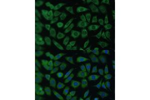 Immunofluorescence analysis of L929 cells using  Polyclonal Antibody (ABIN7265493) at dilution of 1:100 (40x lens). (ARL3 抗体  (AA 1-182))