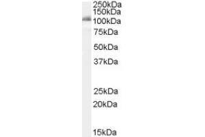 Image no. 1 for anti-Insulin-Degrading Enzyme (IDE) (Internal Region) antibody (ABIN375106) (IDE 抗体  (Internal Region))