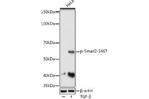 Western blot analysis of extracts of HeLa cells, using Phospho-Smad2-S467 antibody (ABIN3019982, ABIN3019983, ABIN3019984 and ABIN1682048) at 1:1000 dilution. (SMAD2 抗体  (pSer467))