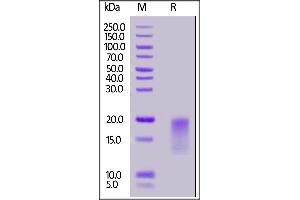 Human BAFFR Protein, His Tag on  under reducing (R) condition.