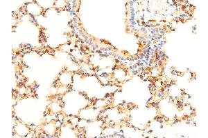 ABIN6267071 at 1/100 staining mouse lung tissue sections by IHC-P. (SYK 抗体  (pTyr323))