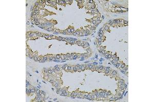 Immunohistochemistry of paraffin-embedded human prostate using DBI Antibody. (Diazepam Binding Inhibitor 抗体)