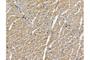 KIR3DL2 Antibody at 1/100 staining rat heart tissue by IHC-P.