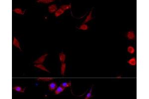 Immunofluorescence analysis of NIH/3T3 cells using CD40L Polyclonal Antibody at dilution of 1:100. (CD40 Ligand 抗体)