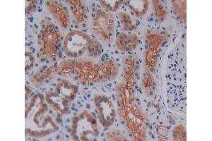Used in DAB staining on fromalin fixed paraffin- embedded kidney tissue (Reelin 抗体  (AA 2086-2296))