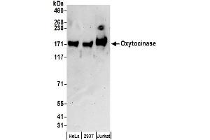 anti-Leucyl/cystinyl Aminopeptidase (LNPEP) (AA 1-50) antibody