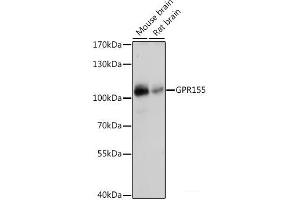 Western blot analysis of extracts of various cell lines using GPR155 Polyclonal Antibody at dilution of 1:1000. (GPR155 抗体)