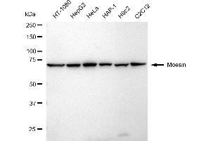 Western blotting analysis using Moesin antibody (ABIN7799482). (Recombinant Moesin 抗体)
