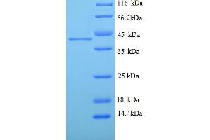 SDS-PAGE (SDS) image for ELAV (Embryonic Lethal, Abnormal Vision, Drosophila)-Like 2 (Hu Antigen B) (ELAVL2) (AA 4-356), (partial) protein (His tag) (ABIN5709467)