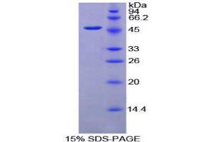 SDS-PAGE (SDS) image for Fibrinogen gamma Chain (FGG) (AA 27-435) protein (His tag) (ABIN1079532) (FGG Protein (AA 27-435) (His tag))
