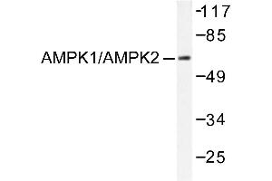 Image no. 1 for anti-Protein Kinase, AMP-Activated, alpha 1 Catalytic Subunit (PRKAA1) antibody (ABIN265306) (PRKAA1 抗体)