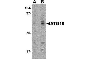 Western Blotting (WB) image for anti-ATG16 Autophagy Related 16-Like 1 (ATG16L1) (Middle Region) antibody (ABIN1030869)