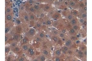 DAB staining on IHC-P; Samples: Human Liver Tissue (CTNNBIP1 抗体  (AA 1-81))