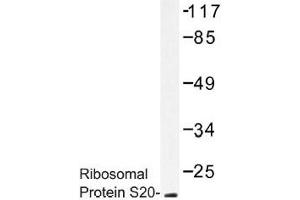 Image no. 1 for anti-Ribosomal Protein S20 (RPS20) antibody (ABIN317813) (RPS20 抗体)