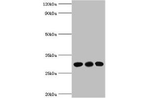 Western blot All lanes: CA1 antibody at 6 μg/mL Lane 1: Jurkat whole cell lysate Lane 2: K562 whole cell lysate Lane 3: Mouse spleen tissue Secondary Goat polyclonal to rabbit IgG at 1/10000 dilution Predicted band size: 29 kDa Observed band size: 29 kDa (CA1 抗体  (AA 1-261))