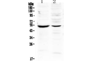 Western blot analysis of MMP16 using anti-MMP16 antibody . (MMP16 抗体  (AA 120-296))