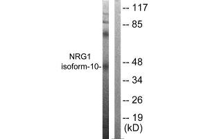 Western Blotting (WB) image for anti-Neuregulin 1 (NRG1) (Isoform 10), (N-Term) antibody (ABIN6299311) (Neuregulin 1 抗体  (Isoform 10, N-Term))