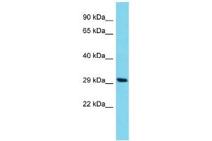 Host: Rabbit Target Name: C14orf105 Sample Type: HCT15 Whole Cell lysates Antibody Dilution: 1. (C14ORF105 抗体  (C-Term))