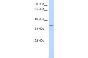WB Suggested Anti-PAQR6 Antibody Titration:  0.