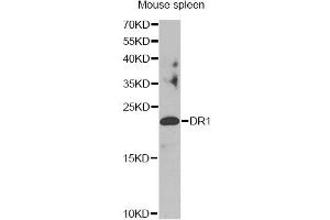 Western blot analysis of extracts of mouse spleen, using DR1 antibody. (DR1 抗体)