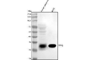 Western blot analysis of TFPI2 using anti-TFPI2 antibody (ABIN7602346).