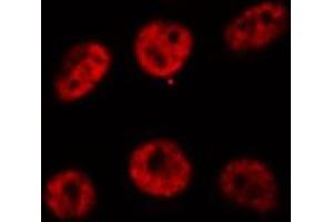 ABIN6269310 staining HeLa cells by IF/ICC. (RUNX1 抗体  (Internal Region))