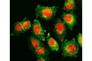 anti-Torsin A Interacting Protein 1 (TOR1AIP1) (AA 1-445) antibody