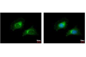 ICC/IF Image CARD6 antibody [N1N2], N-term detects CARD6 protein at cytoplasm by immunofluorescent analysis. (CARD6 抗体  (N-Term))