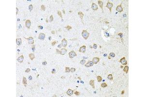 Immunohistochemistry of paraffin-embedded Mouse brain using AKAP5 Polyclonal Antibody at dilution of 1:100 (40x lens). (AKAP5 抗体)