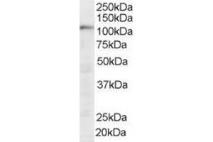 Western Blotting (WB) image for anti-Squamous Cell Carcinoma Antigen Recognized By T Cells (SART1) (N-Term) antibody (ABIN2466239) (SART1 抗体  (N-Term))