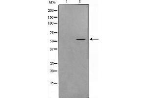 Western blot analysis on COLO205 cell lysate using STEA3 Antibody,The lane on the left is treated with the antigen-specific peptide. (STEAP3 抗体  (N-Term))