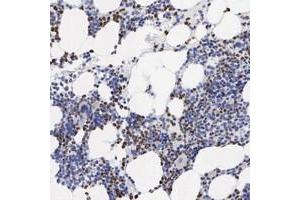 Immunohistochemical staining of human bone marrow with SPIN3 polyclonal antibody  shows strong nuclear and cytoplasmic positivity in bone marrow poietic cells. (SPIN3 抗体)