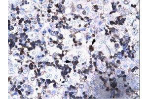 Image no. 1 for anti-Forkhead Box P3 (FOXP3) (AA 100-149) antibody (ABIN202505) (FOXP3 抗体  (AA 100-149))