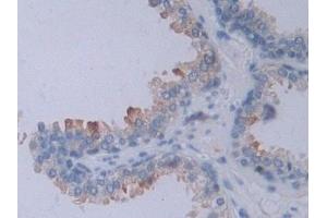 DAB staining on IHC-P; Samples: Human Prostate Tissue (NRP2 抗体  (AA 231-490))