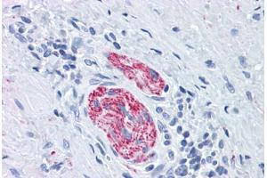 Human Nerve: Formalin-Fixed, Paraffin-Embedded (FFPE) (MAPT 抗体  (Ser404))