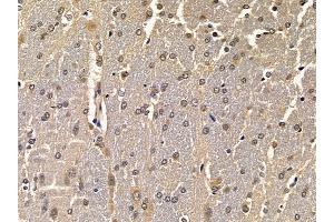 ABIN6258224 and ABIN6275160 at 1/100 staining rat brain tissue by IHC-P. (GRB2 抗体  (C-Term))
