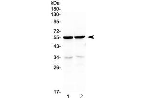 Western blot testing of 1) rat kidney and 2) mouse kidney lysate with PTP1B antibody at 0.