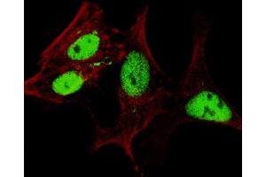 Fluorescent confocal image of SY5Y cells stained with (ABIN655156 and ABIN2844774) LIN28A (Center) antibody. (LIN28A 抗体  (AA 108-138))