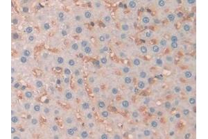Detection of SERPINA10 in Rat Liver Tissue using Polyclonal Antibody to Serpin A10 (SERPINA10) (SERPINA10 抗体  (AA 278-425))