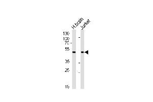 Western blot analysis of lysates from human brain tissue lysate and Jurkat cell line (from left to right), using CHN1 Antibody (N-term) (ABIN1881198 and ABIN2839098).