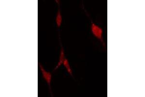 ABIN6274311 staining A549 cells by IF/ICC. (PFKP 抗体  (Internal Region))