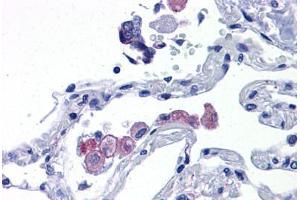 Human Lung: Formalin-Fixed, Paraffin-Embedded (FFPE) (TLR7 抗体  (AA 900-950))