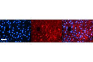 Rabbit Anti-RARA Antibody    Formalin Fixed Paraffin Embedded Tissue: Human Adult liver  Observed Staining: Cytoplasmic (abundant), Nuclear (very rare) Primary Antibody Concentration: 1:100 Secondary Antibody: Donkey anti-Rabbit-Cy2/3 Secondary Antibody Concentration: 1:200 Magnification: 20X Exposure Time: 0.