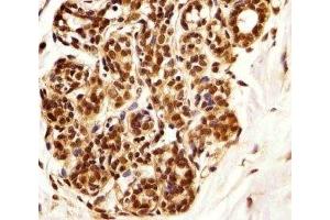 Immunohistochemical analysis of paraffin-embedded human breast using PIN1 antibody at 1:25 dilution. (PIN1 抗体)
