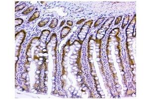 IHC analysis of HAUSP/USP7 using anti-HAUSP/USP7 antibody (ABIN6719603).