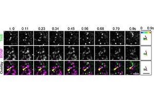 TrkB binds to BDNF at the plasma membrane.