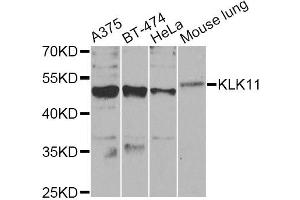Western blot analysis of extracts of various cell lines, using KLK11 Antibody (ABIN5975048) at 1/1000 dilution. (Kallikrein 11 抗体)